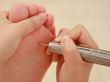 リフレプロの写真