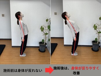 アオ整体院/20代、肩こり・腰痛のお客様☆