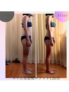 クリオネ(Clione)/リバウンド知らず徹底美姿勢痩身