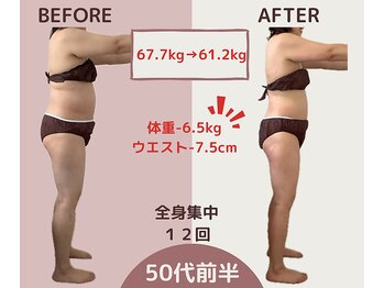 エテルナ(Eterna)/安城市　ダイエット　痩身