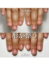 小さい爪がすくすく成長♪