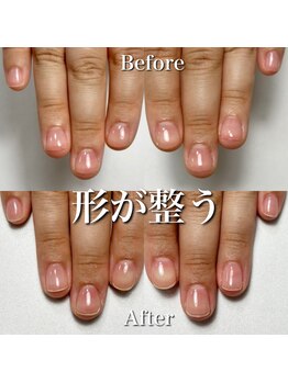 リリー/小さい爪がすくすく成長♪