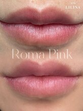 ウィズリリナ 新横浜(with Lilina.)/ローマピンク　術後2ヶ月