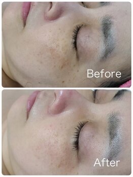 ルル 北仙台/お客様Before/After　くすみ