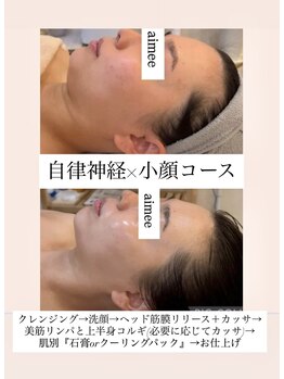 エイミー(Aimee)/【小顔コース】ビフォーアフター