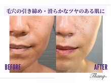 サンク(Thanq)/ヒト幹細胞☆小顔フェイシャル