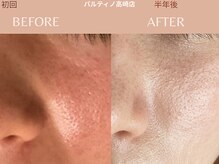 パルティノ 高崎店の雰囲気（毛穴の開き・毛穴の詰まり・透明感ある素肌へ導きます☆）
