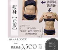 きれい塾 恵比寿/痩身