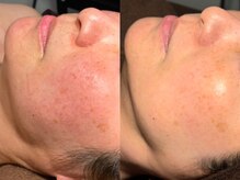 ルーナジェーナ(Luna llena)/池袋　エステ　ルーナジェーナ