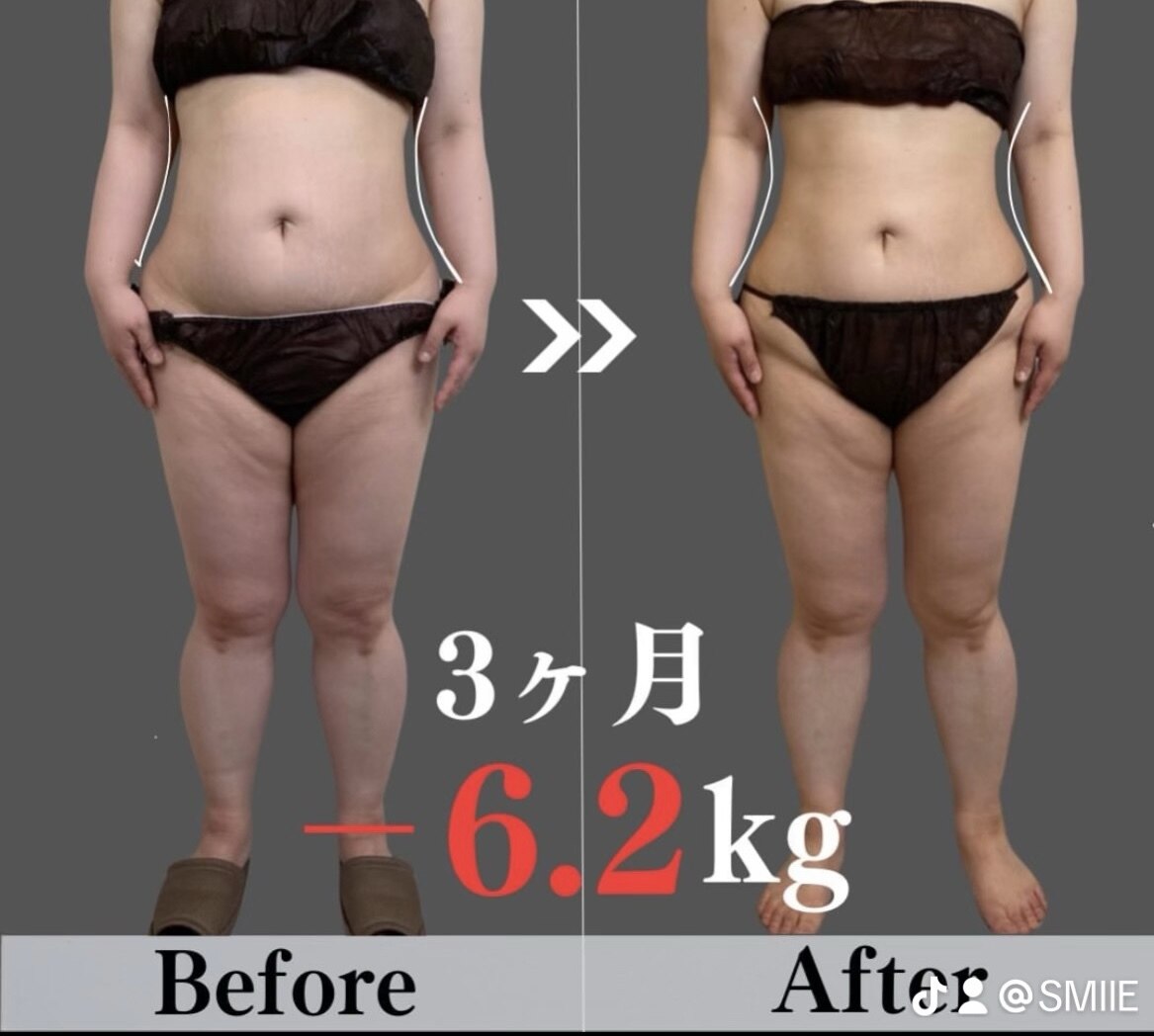 スマイル(SMILE)｜ホットペッパービューティー