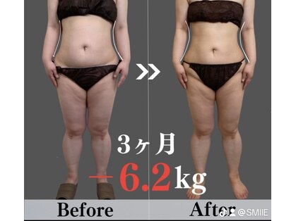 スマイル(SMILE)の写真