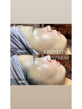 マリー(Mary.)/トゥルントゥルンのお肌へ