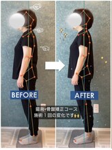 ラクリエ 姫路駅前院(La Creer)/施術ビフォーアフター/反り腰