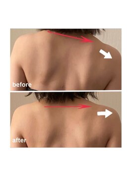 ナチュリィ(natully)/上半身集中経絡リンパ60分