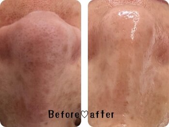 エムエー(MA)/潤艶WAX【鼻】