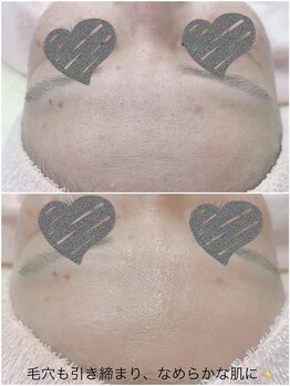 プチ プロムナード(Petit Promenade)/美肌フェイシャルワックス