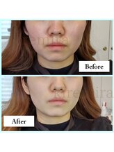 キレミラ 麻布十番店/赤み編