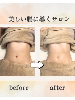 フローラ(FLORA)/施術ビフォーアフター