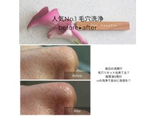 1番人気の毛穴洗浄ですっぴん肌に自信を！