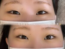 メゾンブーケアイアンドオタヴァ 国分寺(maison Bouquet eye&. otava)/左右差のあるお目元もパッチリと