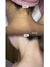 【後ろ姿美人】プロにまかせるうなじワックス脱毛