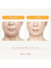 ミーティア(Meteor)/