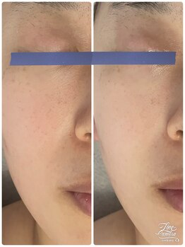 リッチベル(richbelle)/