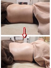 ムーンブロッサム(MoonBlossom)/4か所から選べるウエスト集中☆