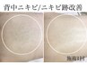 【継続相談向け】毛孔性苔癬.背中ニキビ★背中ハーブ×ハイドラ洗浄×パック