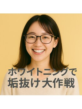 ラブホワイトニング 新宿店(LOVEホワイトニング)/セルフホワイトニング専門店