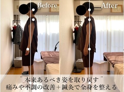 クーロ鍼灸院(curo鍼灸院)の写真