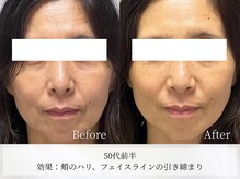 アストリエ グレース 相模大野(Astorie Grace)/1回でもリフトアップ♪