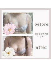 アリサナ(Arisana)&nbsp;症例写真 バストケア