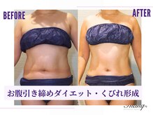 サンク(Thanq)/お腹サイズダウン・腰肉スッキリ