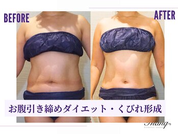 サンク(Thanq)/お腹サイズダウン・腰肉スッキリ