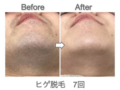 ナルシスの写真