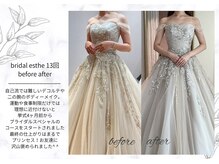 アモリール(Amolir)の雰囲気（結果に差が出る独自の【ブライダル痩身】でドレス映え美ボディに）