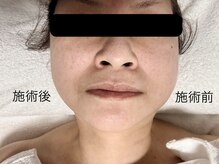 サイ(sai)/光フェイシャル