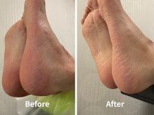 ハルテドットハチロク(HALUTE.86)