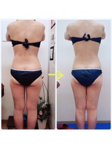 アーズ(A-Z)/【キャビゼロ痩身】全身