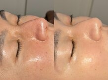 ルーナジェーナ(Luna llena)/池袋　エステ　ルーナジェーナ