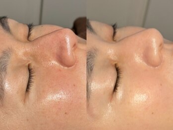 ルーナジェーナ(Luna llena)/池袋 エステ ルーナジェーナ