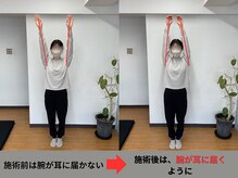 アオ整体院/20代、肩こり・腰痛のお客様☆