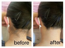 グッディ 北条店(Goody)/《脱毛》えり足