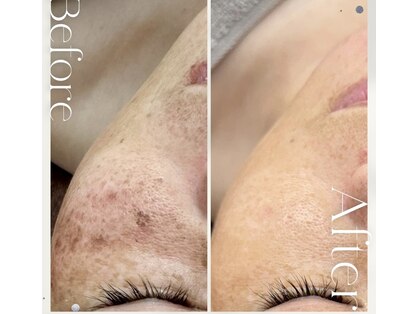 シルキーエービューティー(Silky A Beauty)の写真