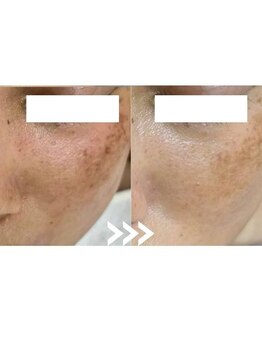 ソイ(Soi)/朝のメイク時間から解放♪