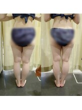 マイフェアレディ 今池(MyFairLady)/最強ラフォス&リンパマッサージ