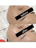【毛穴・ハリ艶・乾燥】看護師ナノダーマ美容液導☆つるんと水光肌