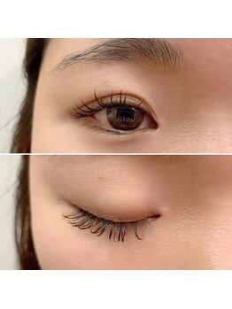 リコル(Ricol)/ブラウンmix