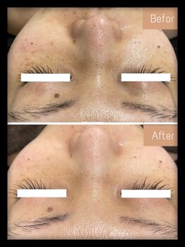 FJ/美白も効果◎